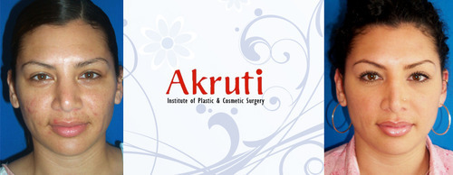 Desktop akruti